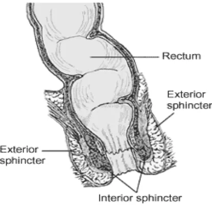 Fig. 5.   Inter sphincter resection for rectal cancer 