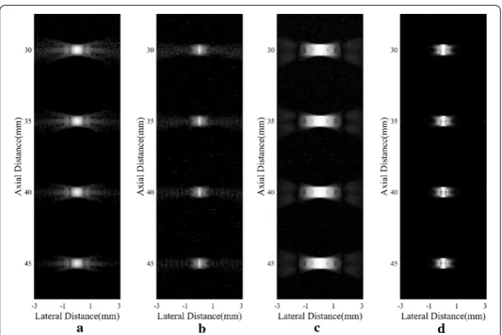 Fig. 1 Simulated point scatterers: a DAS, b MV, c SLSC, d DA-MV SLSC. The a and b are B-mode images shown with a dynamic range of 60 dB