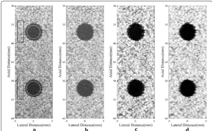 Fig. 3 Simulated anechoic cysts: a DAS, b MV, c SLSC, d DA-MV SLSC. The a and b are B-mode images shown with a dynamic range of 60 dB