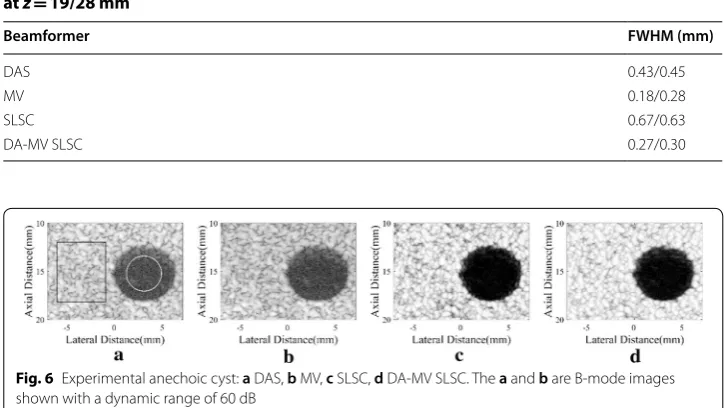Table 4 Full-width at at half-maximum (FWHM) for the beamformed responses z = 19/28 mm