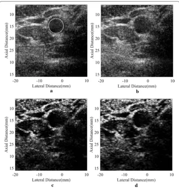 Fig. 7 In vivo human carotid artery: a DAS, b MV, c SLSC, d DA-MV SLSC. The a and b are B-mode images shown with a dynamic range of 60 dB