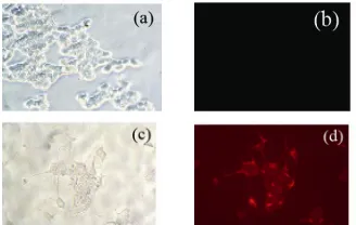 Figure 4. Neuronal-like differentiated and the immunocytochemistry of the NF-200. The cells with neuronal-like morphology after differentiation maturated cells (×200)