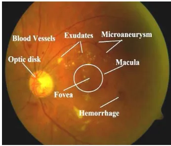 Fig. 1.Normal Retinal Fundus Image 