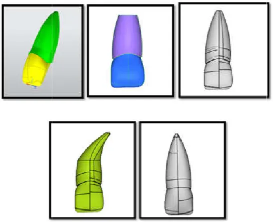 Fig. 2. Geometric model showing maxillary incisor with different root morphologiesGeometric model showing maxillary incisor with different root morphologiesGeometric model showing maxillary incisor with different root morphologies   