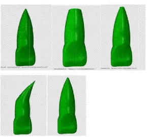 Fig 4. Finite element model of maxillary incisor with different root morphologiesFinite element model of maxillary incisor with different root morphologiesFinite element model of maxillary incisor with different root morphologies    