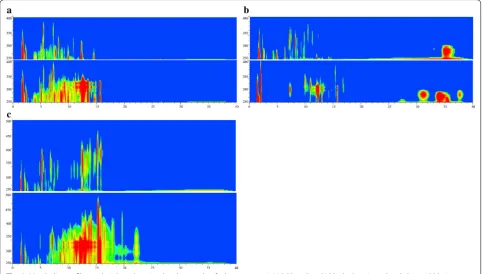 Fig. 5 The expression levels of eGFP in fluorescence microscope. The observed mycelia are sampled from YEME fermentation broth at 24 h
