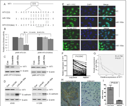 Fig. 3 miR-193a modulates E-cadherin expression through targeting WT1.by qRT-PCR.was performed in lysates from A549 cells, which were treated as Fig