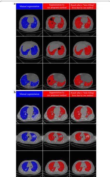 Fig. 5 Examples of segmentation at axial slices (In each sub-figure, there are three columns: the left the left column shows the results of manual segmentation of lung field including both lung parenchyma and lesions; the middle column presents the results