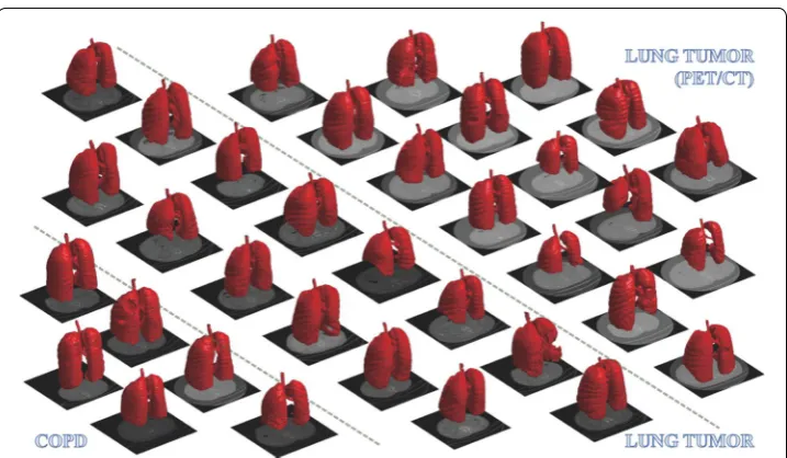 Fig. 7 Examples of segmentation shown using 3D surface rendering