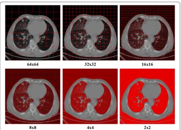 Fig. 3 Segmentations using k-means clustering with different patch sizes