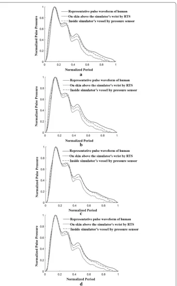Fig. 10 Comparison of pulse waveforms measured on a human’s wrist using RTS, on a simulator’s wrist using RTS and inside simulator’s vessel (tube) using a pressure sensor with varying heart rate and pulse pressure: a case with heart rate of 65 bpm and pulse pressure of 50 mmHg, b case with heart rate of 65 bpm and pulse pressure of 60 mmHg, c case with heart rate of 75 bpm and pulse pressure of 50 mmHg, d case with heart rate of 75 bpm and pulse pressure of 60 mmHg