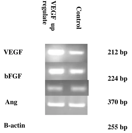Figure 2 - The mRNA expression of basic fibroblast growth factor (bFGF), Vascular endothelial growth factor (VEGF), Angiogenin, and β-actin used as an internal control