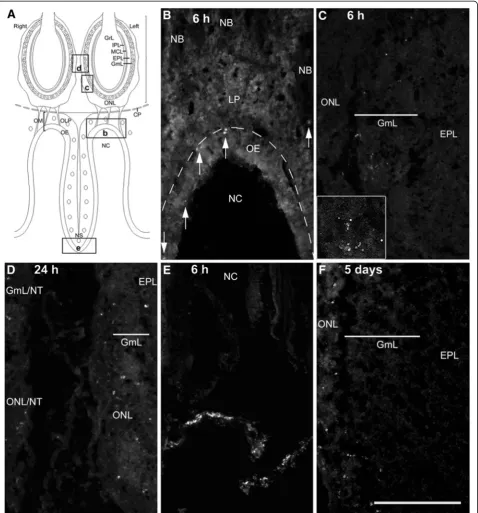 Figure 3 (A) Line drawing of transverse section of olfactory bulbs and mucosa shows the locations from which micrographs (B-E) wereaggregates of bacteria