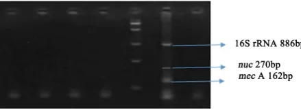 Figure 3. Multiplex PCR Analysis of Uncultured Clinical Samples. Legend: Lane C— Negative Control, Lane PC—Positive Control, Lane M—Molecular Size Marker (100 bp), Lane 1—Wound Swab, Lane 2—Nasal Swab, Lane 3 & 4—Wound Swab, Lane 5—Pus Swab, Lane 6—ET Secr