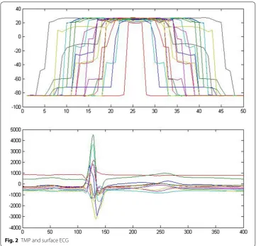 Fig. 2 TMP and surface ECG