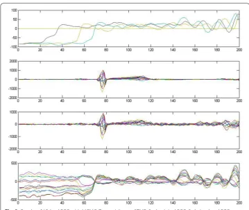 Fig. 3 Results of 12‑lead ECG with MCMC. Top: atrial part of TMP; 2nd: original ECG; 3rd: simulated ECG; bottom: atrial part of simulated ECG