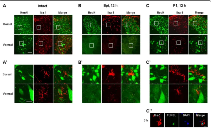 Figure 3 Microglial behavior in SCI is not correlated with neuronal death. Cross sections were obtained from the intact spinal cord (A, A ’), epicenter (B, B ’), and P1 regions (C, C’, C”) in the caudal direction at the indicated times after injury, and do