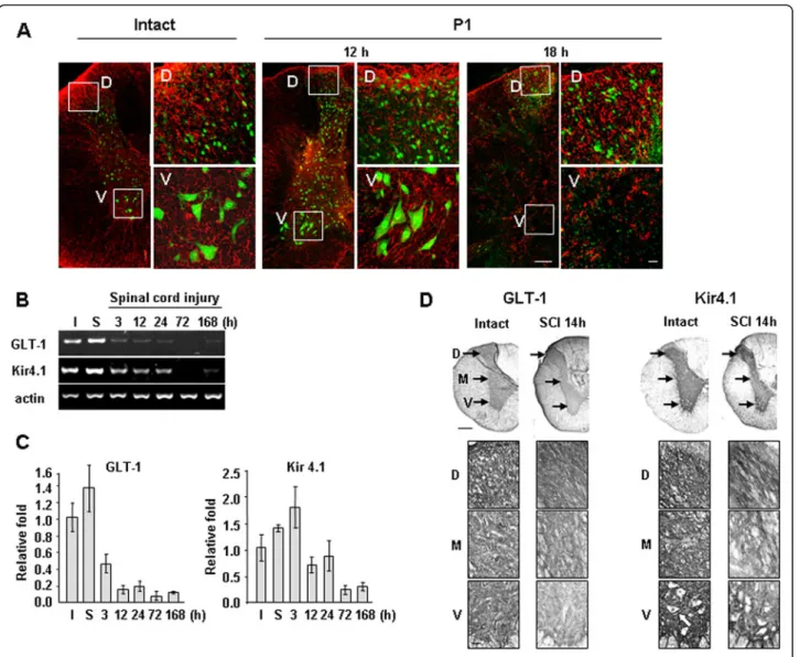 Figure 5 Loss of astrocytes and reduced expression of GLT-1 and Kir4.1 in injured spinal cords