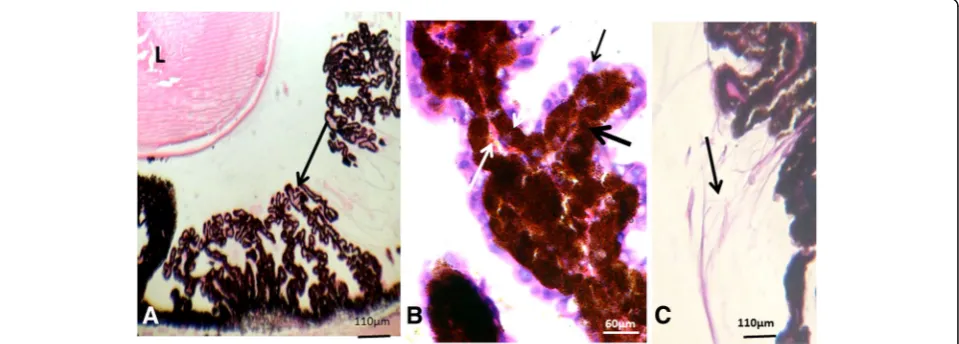 Fig. 2 Retina, sclera and choroid. Light micrograph showing thesclera (arrow), choroid highly pigmented (C) and retina (R).Masson’s trichrome stain