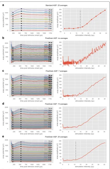 Fig. 3 Example of AGF recordings. Fixed latencies were used for N1 (233 µs) and P2 (575 µs)