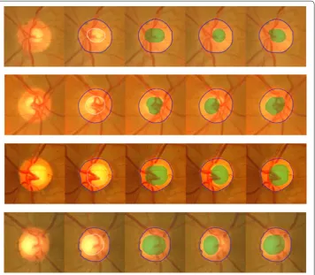 Fig. 6 Illustration of comparisons among the segmentation results. From left to right are original images, results achieved by experts, by Joshi et al., by Liu et al