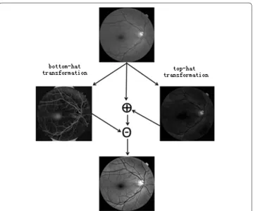 Fig. 2 Flowchart of image contrast enhancement by top-hat and bottom-hat transforms. The top is the original image and the bottom is the result