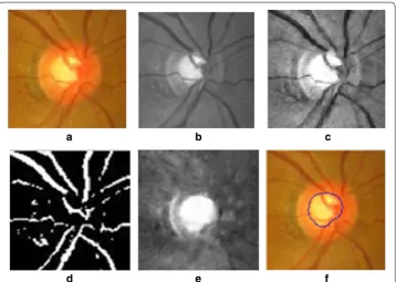 Fig. 3 Key steps in proposed optic cup segmentation. channel image, a Original image, b G channel image, c enhanced G d blood vessel identification, e result of blood vessel inpainting, f optic cup identification