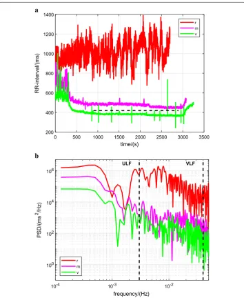Fig. 1 Data records for a single participant at the three intensity levels. RR intervals