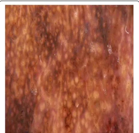 Fig. 6 The exemplary image subject to percolation process