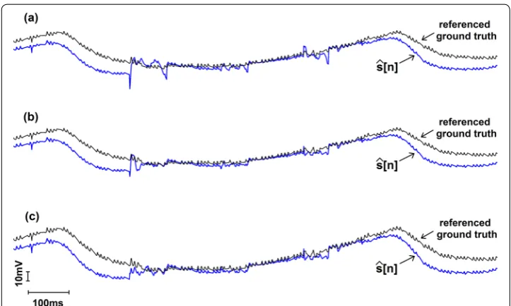 Fig. 4 Qualitative representation of the NIRS signal after replacing the 3 artefacts containing segments by de-noised signal along with the referenced ground truth signal from the other NIRS channel which is analogous to “ground truth” signal