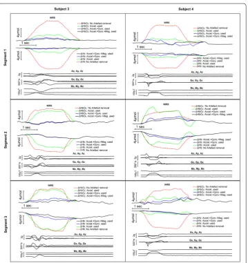 Fig. 5 Effect of estimating and removing movement artefacts using multi-channel IMU signals on  HbO2 and Hb change detection