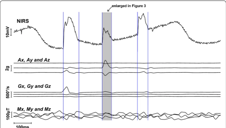 Fig. 2 Raw data of one channel NIRS signal containing 3 noise segments indicated by vertical blue lines and corresponding 9 channel IMU signals