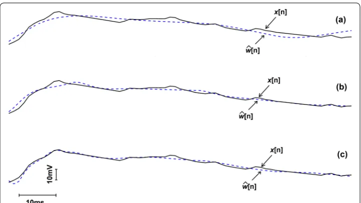 Table 1 SNR improvement of  6 representative segments of  noise in  the  recording from the subject 1 and 2, when various number of IMU channel data were used to remove 