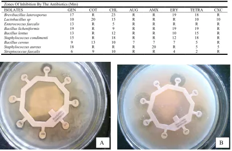 Table 3. Antibiotic susceptibility profile of the gram positive bacterial isolates  