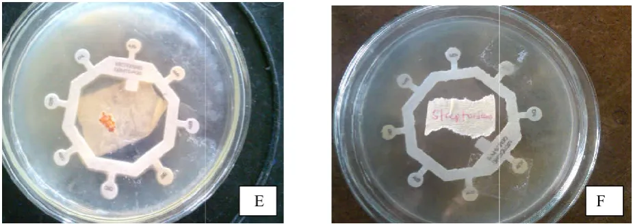 Figure 3 (E) Antibiotic susceptibility result of Staphylococcus aureus  (E) Antibiotic susceptibility result of  (F) Antibiotic susceptibility result of  (F) Antibiotic susceptibility result of Streptococcus faecalis 