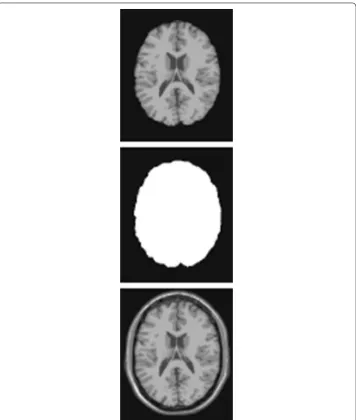 Fig. 8 The MR image (top), its binary mask (middle) and the extracted brain region (down)