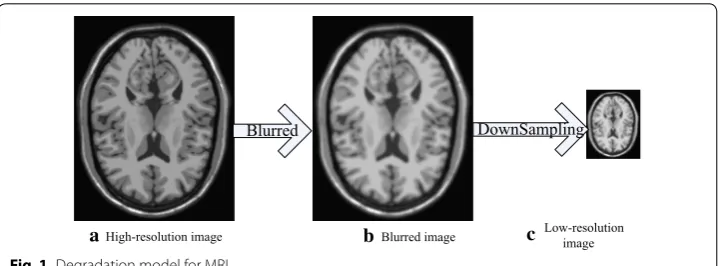 Fig. 1 Degradation model for MRI