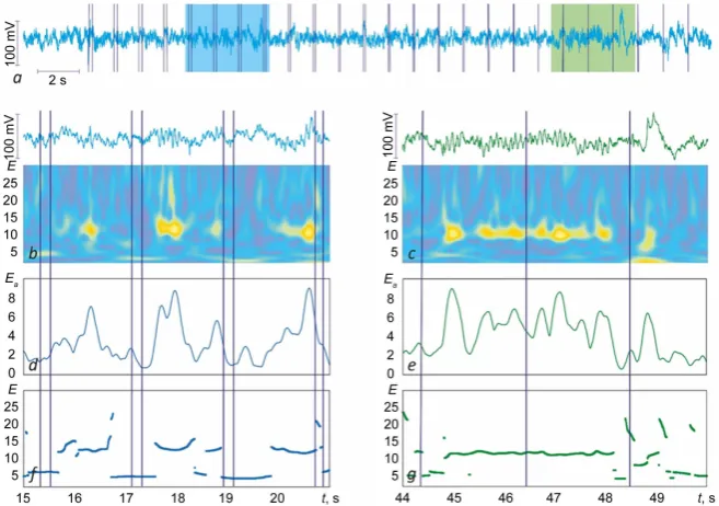Figure 1. Example of EEG recording for 10 channels during perception of visual stimuli: green dashed marker corresponds to the start of series; dark blue solid markers corres-pond to the start and the end of presentation of each image in series