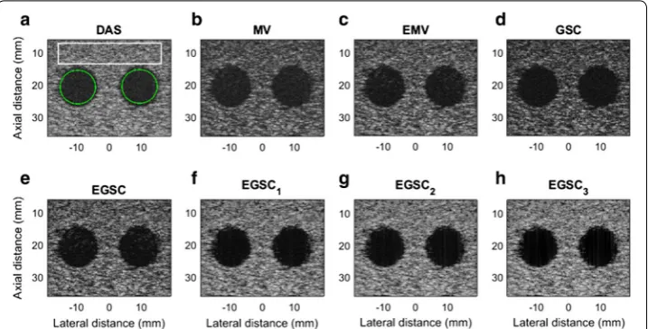 Table 3 Full width at half maximum and peak side lobe level results for simulated point targets for different beamformers