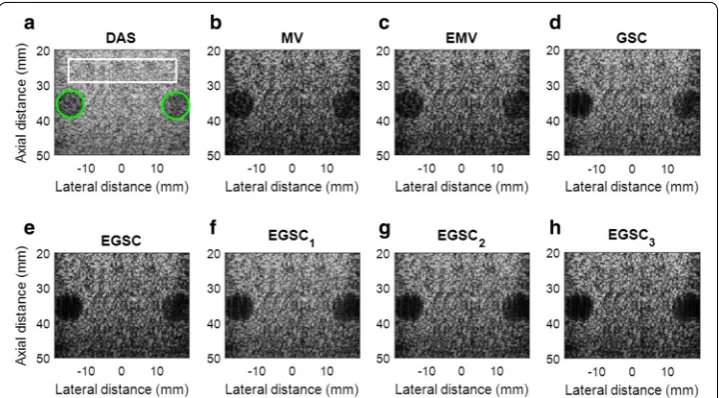 Fig. 10 The beamformed responses of circular anechoic cysts using phantom data for different techniques: a DAS, b MV, c EMV, d GSC, e EGSC, f EGSC1 , g EGSC2 and h EGSC3 , respectively