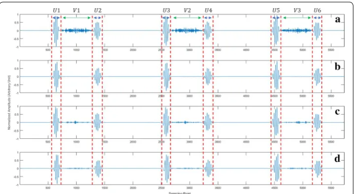 Fig. 7 Murmur elimination effect for heart sound containing S4 and systolic murmurs using the three methods