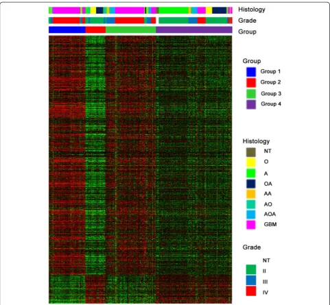 Fig. 4 K-means clustering identified four groups of 310 CGGA samples by UG. K-means clustering identified of 310 CGGA samples by 1091 geneswhose expression most strongly correlated with grade from TCGA database for k = 4