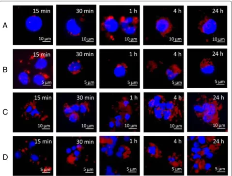 Fig. 4 Intracellular NP distribution evaluated by fluorescence microscopy. Hepa 1–6 (a and c) and monocytes (b and d) were loaded with either50 μg/mL PLGA-Rhod NPs (a and b) or PLGA-Rhod/PEI NPs (c and d) at different time points