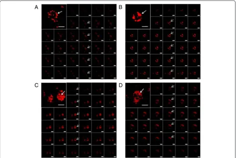 Fig. 5 Analysis of intracellular NP distribution by CLSM. monocytes were loaded with 50 μg/mL PLGA NPs at different time points (a 30 min; b 1 h; c 4 h;d 24 h)