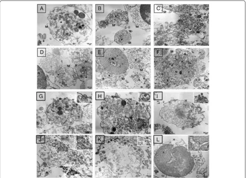 Fig. 6 TEM ultrastructural study. Monocytes were loaded at different time points with either 50 μg/mL PLGA NPs (a 15 min; b 30 min; c 24 h) orPLGA/PEI NPs (d 15 min; e 30 min; f 24 h)