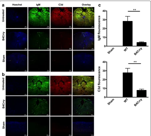 Fig. 7 B4-Crry treatment reduces both IgM binding and C3d deposition after SCI. Analysis of of IgM and C3d deposition in vehicle treated, B4-Crry treated, and in sham operated animals at 72 h after SCI