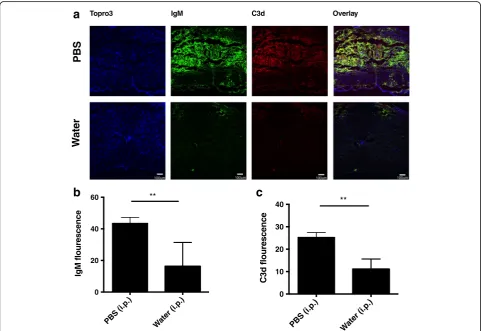 Fig. 4 B1 B cell depletion reduced IgM deposition and complement activation in the injured spinal cord