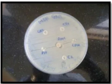 Figure 1: Conventional Antibiotic Disc Showing  Multi Drug Resistance to GPC strain  