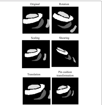 Fig. 7 Examples of reported phantom map image transformations, including rotation, scaling, shearing, translation, and pin cushion transformation in contrast to the original phantom map shape