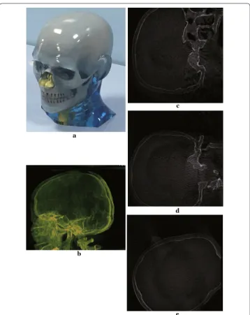 Fig. 8 Reconstruction result of a head phantom. a The head phantom. b MIP of reconstruction result